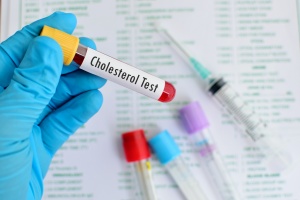 test tube with flood for Signs Of High Cholesterol