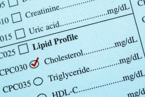 test results about cholesterol by primary care doctors