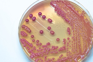 media plate bacteria culture growth on plate at a on-site laboratory