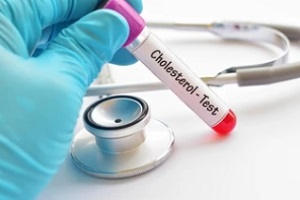 cholesterol test sample in tube