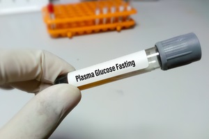 sample tube of plasma glucose fasting test