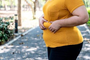 An obese woman in the park