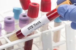 std test