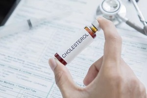 Durham, NC man holding a small bottle with cholesterol written on it