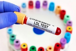 ldl test sample from North Carolina resident