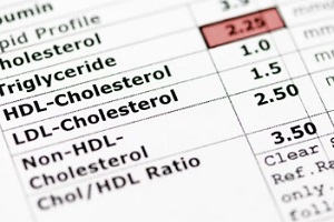 Durham, NC cholesterol test results