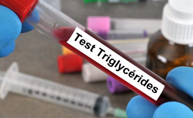 testing triglycerides in blood in NC
