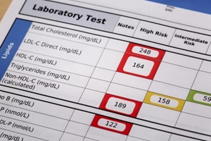 high risk cholesterol test results