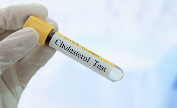 taking blood sample for cholestrol screening