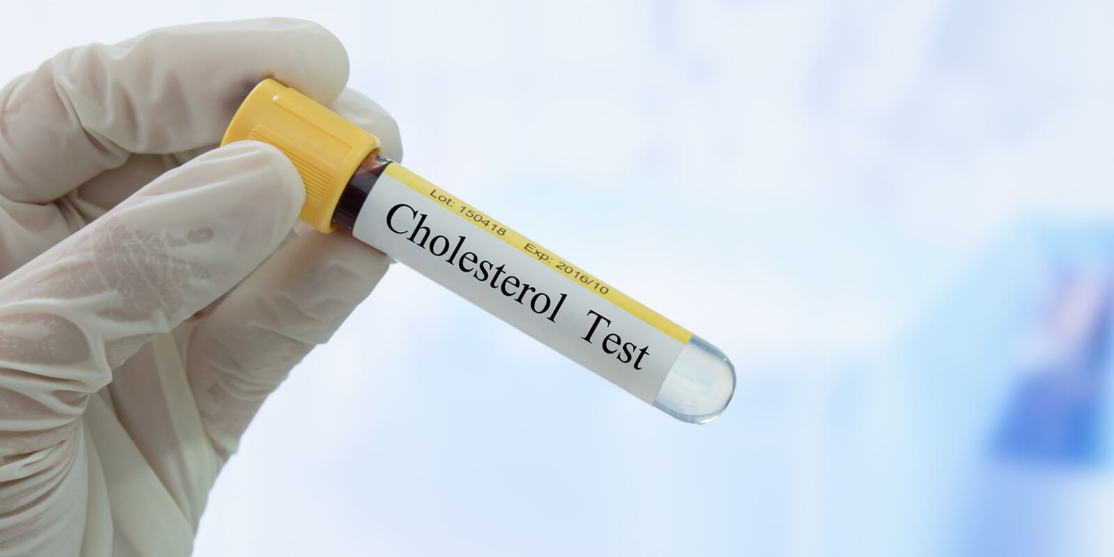 Know Your Numbers: The Importance of Regular Cholesterol Screenings ...