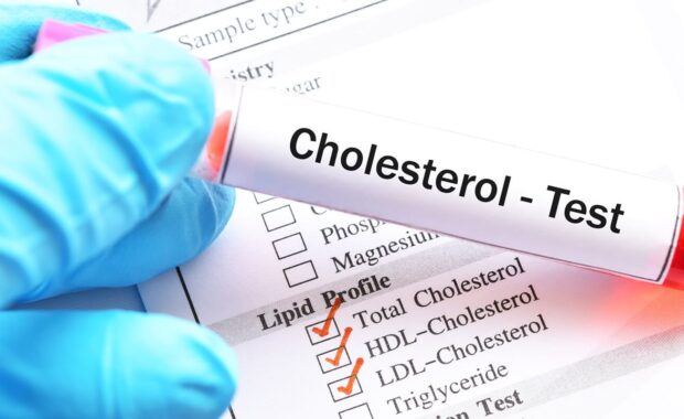 test tube with blood sample for cholesterol test