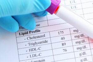 Cholesterol Test Results