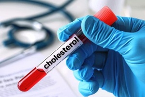 blood sample for cholesterol test