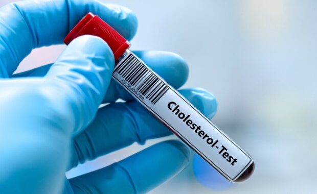 blood sample tube for cholesterol test analysis