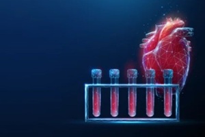 abstract red human heart with blood sample rack