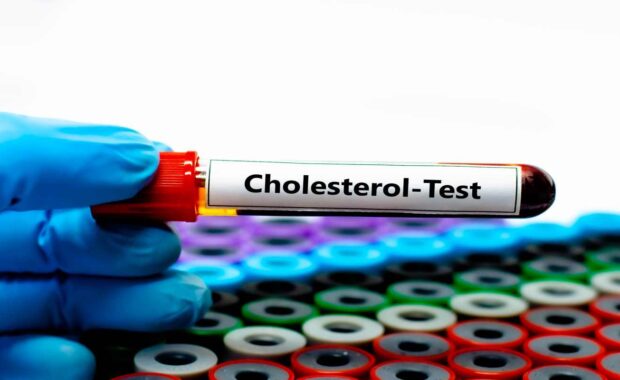 Hand Holding Blood Sample Tube for Cholesterol test in Durham. NC primary care provider