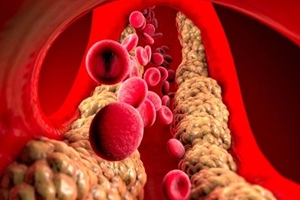 cholesterol formation, fat, artery, vein, heart. Red blood cells, blood flow