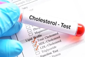 test tube with blood sample for cholesterol test