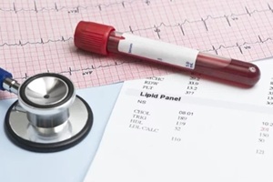 lipid panel EKG